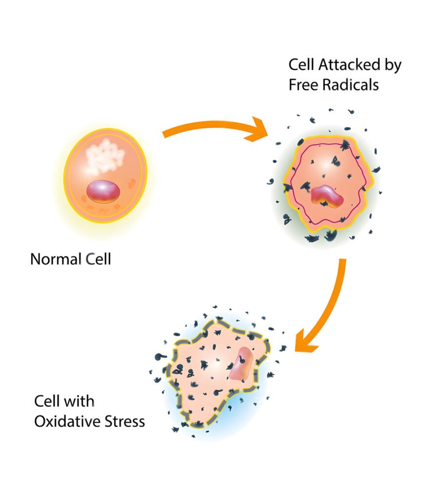 What is Oxidative Stress 1